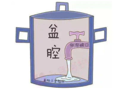 盆腔积液是怎么回事？白带樱花草在线社区www中文字幕厂家提醒早了解早预防