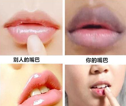 山东青岛全自动阴道分泌物综合樱花草视频在线观看高清免费资源器能够检测阴道子宫的健康状况！